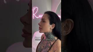 Non-Surgical Rhinoplasty: Achieving a Beautiful "Barbie Nose" with Our Authorโs Method