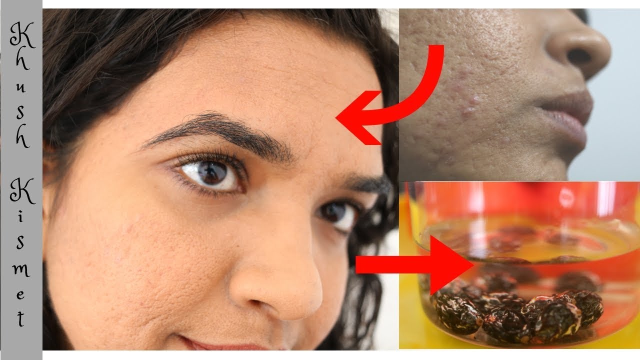 Soaked raisins (khishmish) to CLEAR toxins and ACNE YouTube