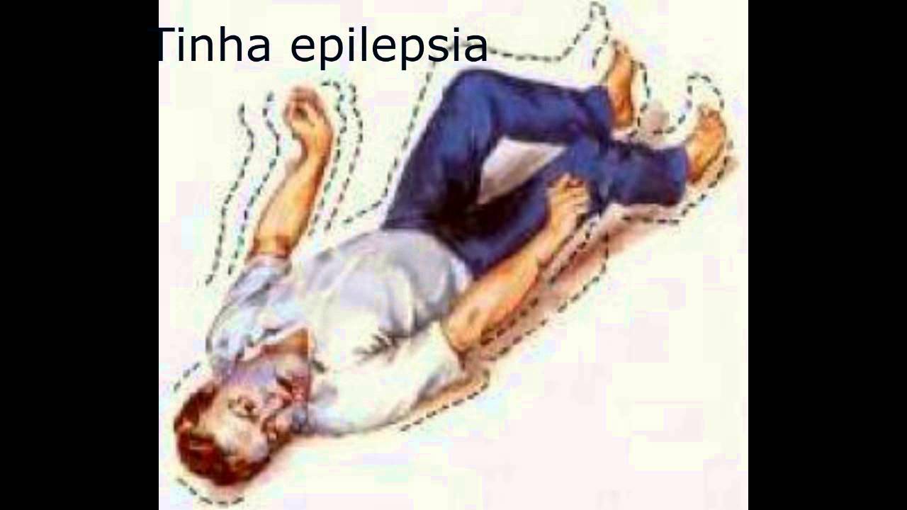 Эпилепсия диабет