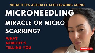 Microneedling Miracle Or Micro Scarring? What Nobodys Telling You
