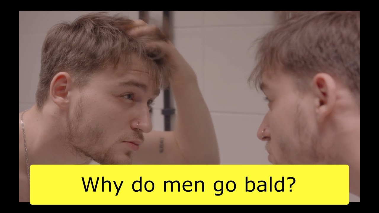 Why Do Men Go Bald YouTube why-do-men-go-bald-youtube