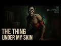 THEY TOLD ME IT WAS JUST A RASH — UNTIL IT MOVED | Creepypasta Horror