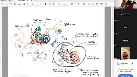 Complex Tinnitus & Hearing Loss Community Call | Seeking Balance International
