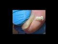 Sharp, inlaid armor is like scissors~ #satisfying #pedicure
