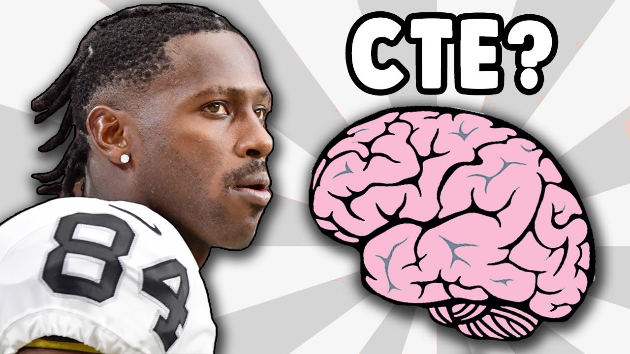 Could Antonio Brown Have Cte Doctor Reacts To Media Speculation Youtube Could Antonio Brown Have Cte Doctor Reacts To Media Speculation Youtube
