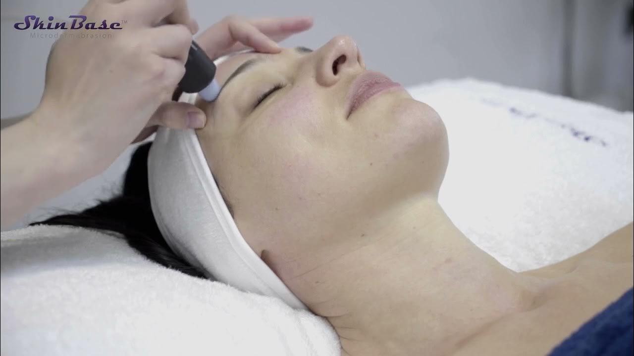 SKINBASE MICRODERMABRASION TREATMENT WHAT'S INVOLVED? YouTube