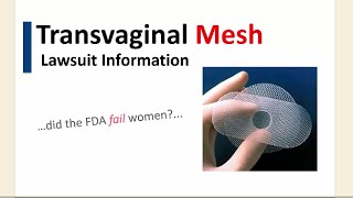 Transvaginal Mesh Lawsuit 2016: Has The FDA Failed Women?