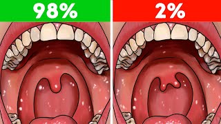 12 Đặc Điểm Cơ Thể Hiếm Gặp Nhất Khiến Bạn Trở Nên Khác Biệt