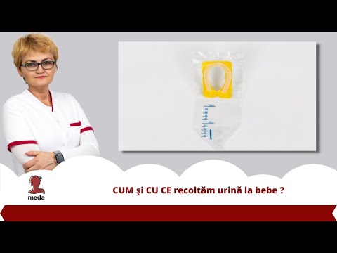 Video: Cum Se Colectează Urina De La Un Nou-născut