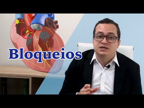 Vídeo: Bloqueio Cardíaco: Sintomas, Tratamento, Graus