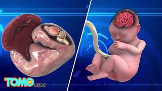 Zika Outbreak How Does The Zika Virus Damage The Brain? - Tomonews