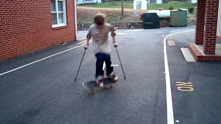 kid on crutches skateboards better than you