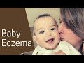 Baby Eczema Treatment Ideas | Our Journey So Far...