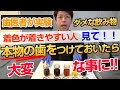 [実験] 着色の原因になる飲み物はコレだ！★ホワイトニングや着色除去した後に飲まない方がよい飲み物を現役歯医者がはっきりさせました。