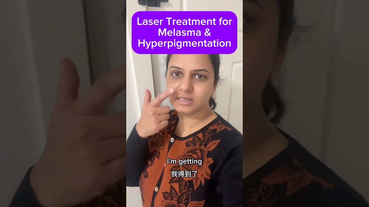 Laser Treatment – Melasma & Hyperpigmentation #melasma #lasertreatment #hyperpigmentation #skincare