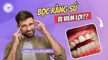 CẢNH BÁO NGUY CƠ VIÊM LỢI KHI BỌC RĂNG SỨ! CÁC ĐIỀU TRỊ HIỆU QUẢ NHẤT LÀ GÌ?