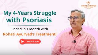 From 4 Years of Psoriasis Itching to Clear Skin in 30 Days with Rohati Ayurved