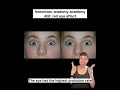 Insomniac anatomy academy 408: red eye effect #science #stem #sciencefacts #anatomy #eyes