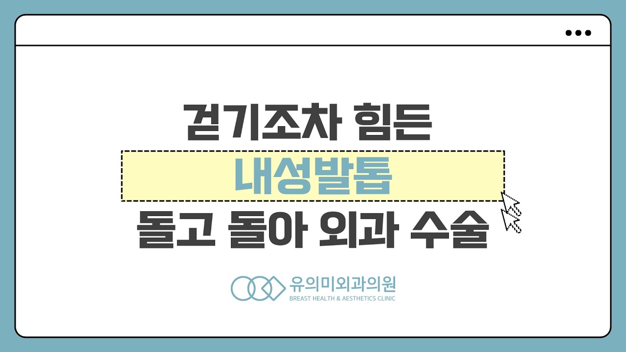 걷기조차 힘든 내성발톱, 돌고 돌아 외과 수술