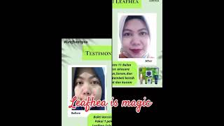 Testimoni pemakaian rutin produk Leafhea