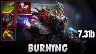 BURNING URSA SAFE LANE | DOTA 2 PATCH 7.31B PRO GAMEPLAY