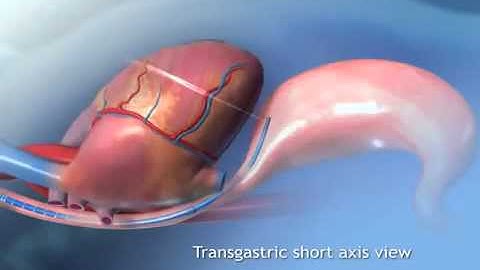 ClariTEE 3D animation