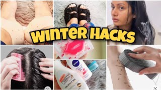 BASIC WINTER HACKS FOR EVERYONE | Easy hacks for winter skincare, bodycare, haircare, lipcare