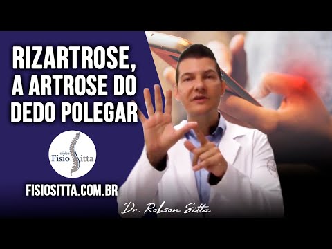 RIZARTROSE ARTROSE do POLEGAR PROTOCOLO de TRATAMENTO em CASA Clínica Fisioterapia Dr. Robson Sitta