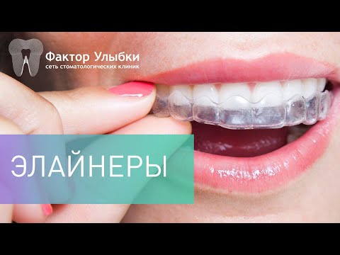 Вопрос: Как выпрямить зубы без брекетов?