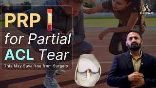 PRP for ACL Tears – A Non-Surgical Option