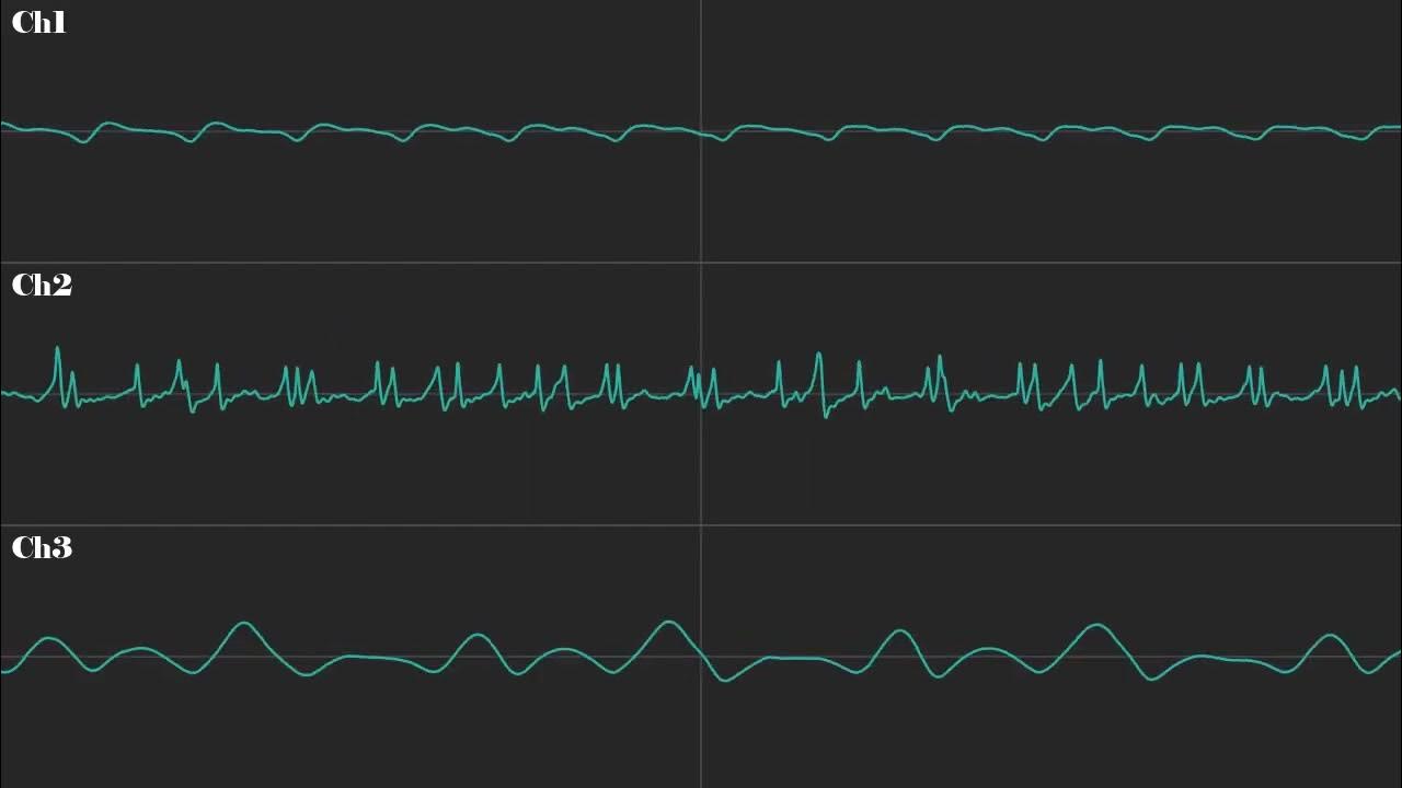 (Wallace And Gromit) "Walkies" (Techno Trousers Music) [Attempted