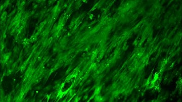 Cardiac-Adaptive Conductive Hydrogel Patch Enabling Construction of Mechanical–Electrical Movie 3