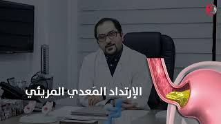 الارتداد المريئي ، الحرقة ، الحموضة  اسبابها و علاجها - الدكتور طارق مزاوي اخصائي الجهاز الهضمي