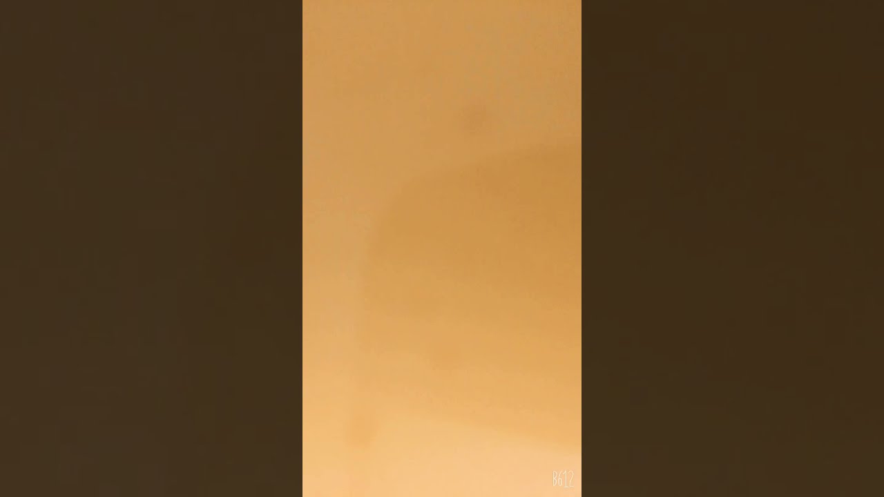 𝚃𝚠𝚒𝚗𝚔𝚒𝚎 𝚋𝚛𝚎𝚊𝚍 🍞