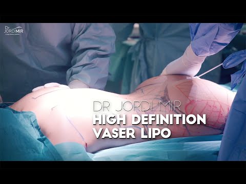 Lipo Vaser de alta definición