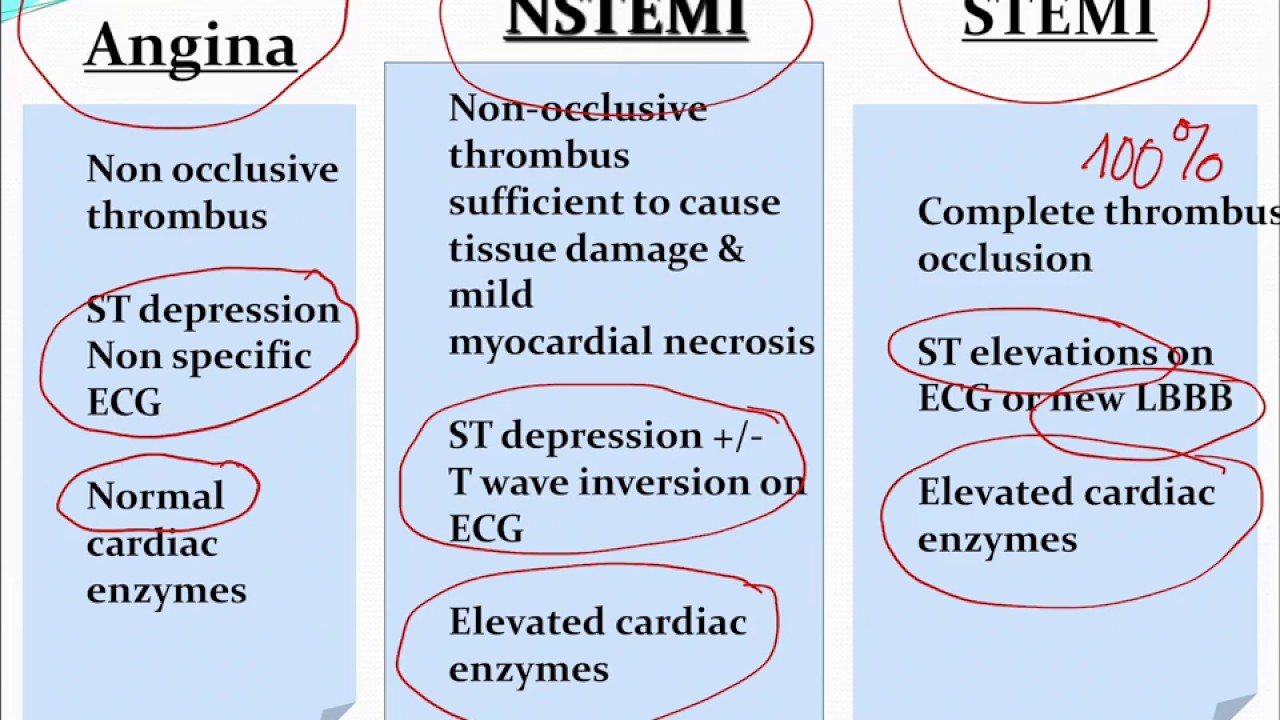 Approach to Chest Pain