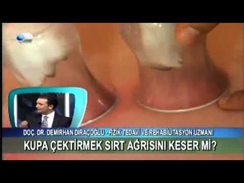 Kupa çektirmek sırt ağrısını keser mi?