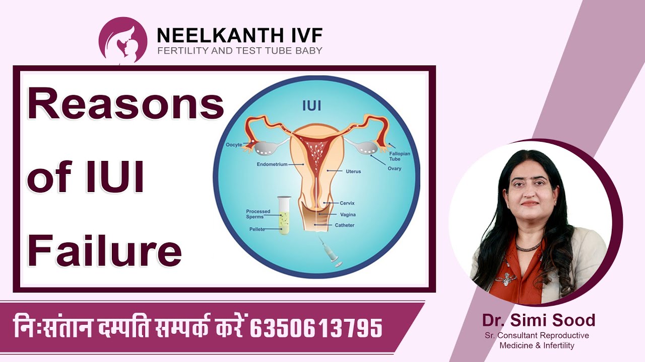 IUI Failure Reasons | IUI Treatment for Pregnancy - YouTube