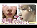 【美肌】ニキビや毛穴を改善！美肌のためにしてること・やめたこと！【スキンケア】