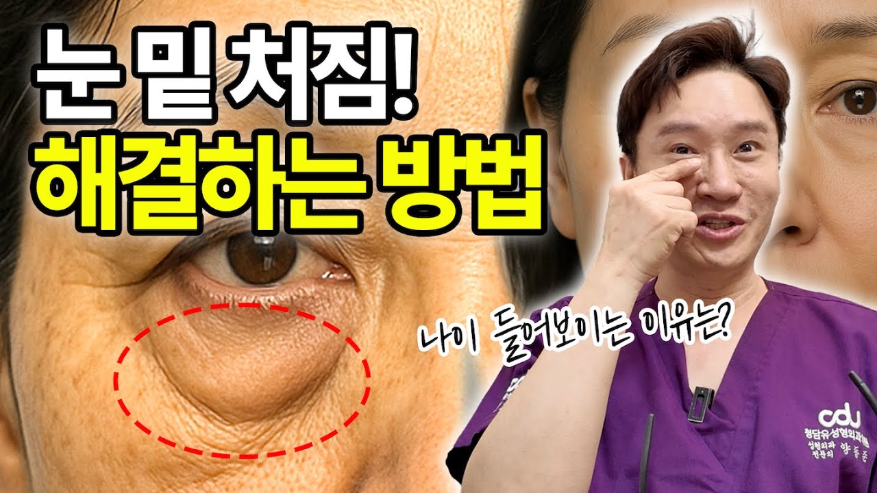(*ENG/CHN/JP) 눈밑 처짐, 눈 밑이 불룩 해지는 진짜 이유!! 돈안쓰고 집에서 좋아지는 방법