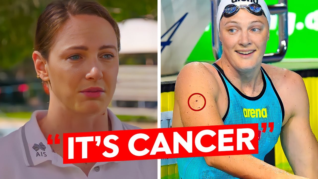 Olympic Swimmer Cate Campbell Diagnosed With Melanoma..