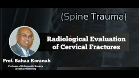 Radiological Evaluation of Cervical Fracture ( Prof. Bahaa Koranah )