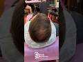 Thinning hair? Reach out for a free consultation. Scalp Dynamics, Sydney Australia