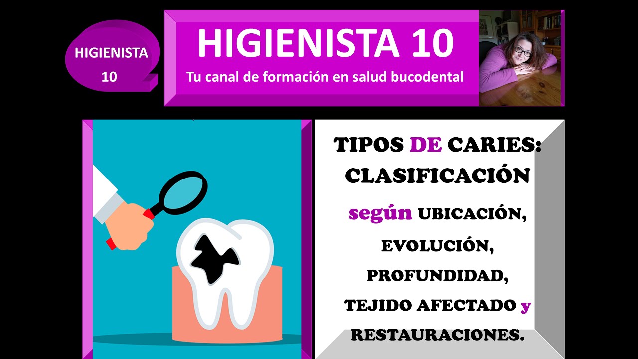 Tipos de caries: clasificaciones según su ubicación, evolución ...