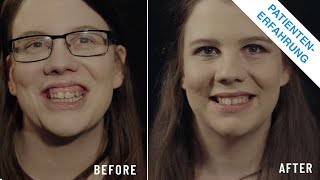 GUMMY SMILE - Kieferorthopädische Restauration in zwei Monaten (Before and After) | Semlinger