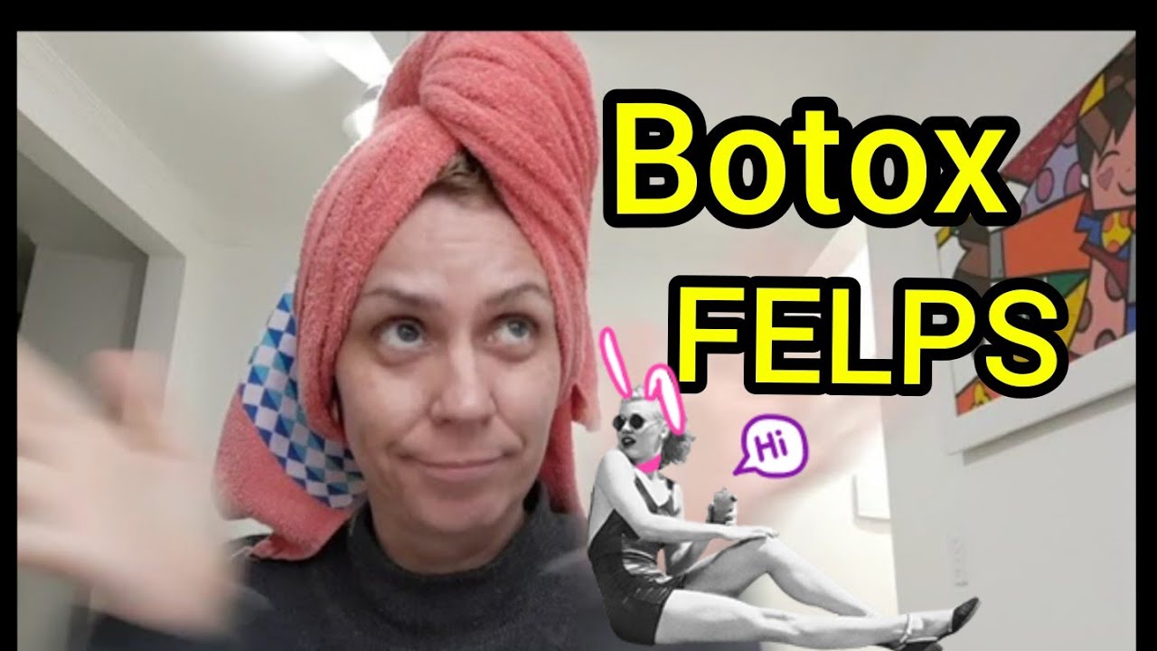 BOTOX DA FELPS . Aplicação e resultado.