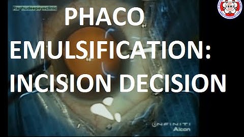 Phacoemulsification: Incision Decision: Dr. Vaishali Vasavada