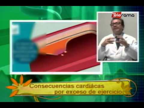 Consecuencias cardiácas por exceso de ejercicio
