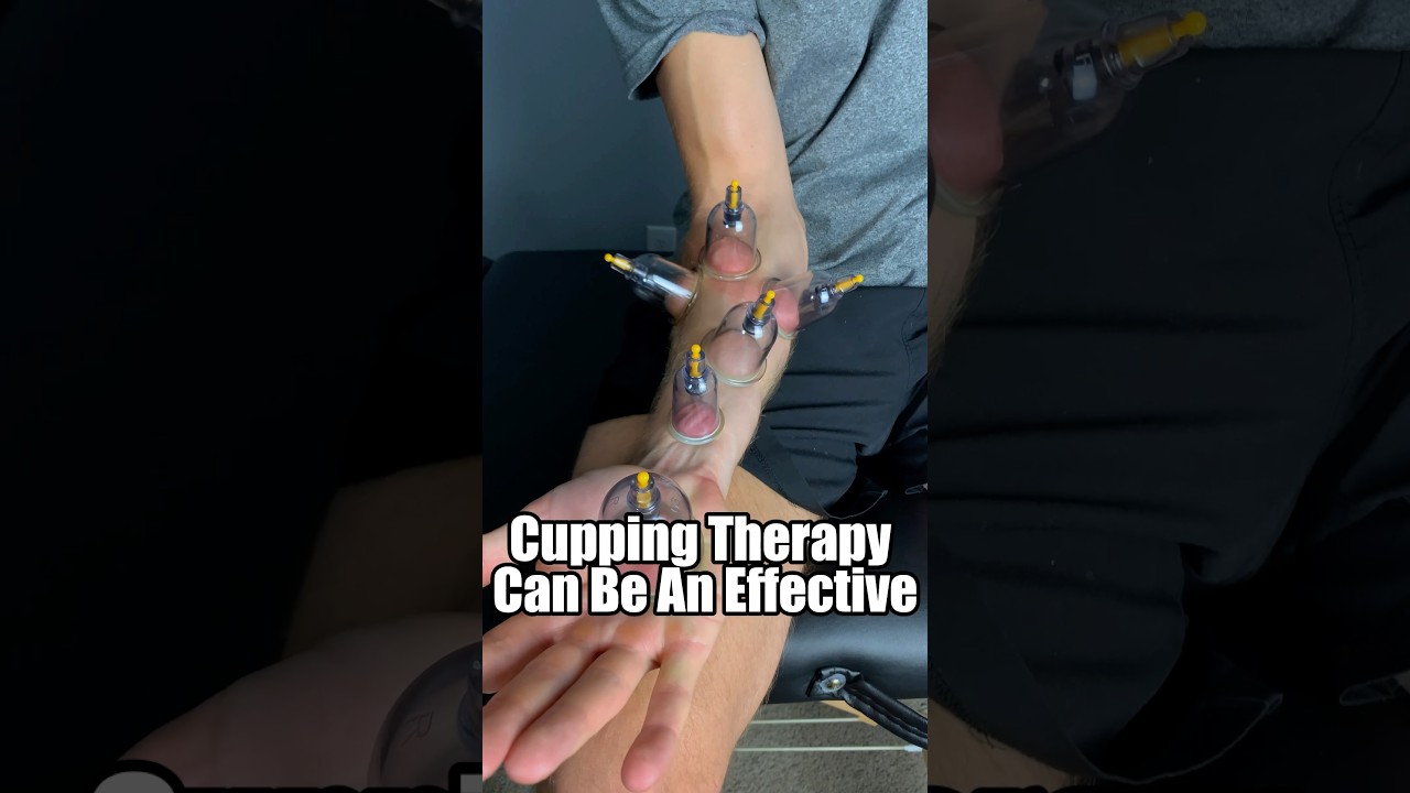 Cupping Therapy Hacks to Instantly Relieve Median Nerve Numbness! 