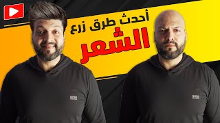 أحدث طريقة لحل تساقط الشعر و القضاء على الصلع نهائيا